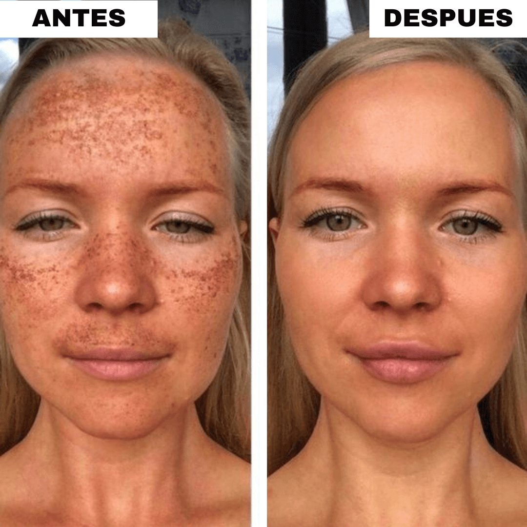 Pack Almohadillas Faciales Anti-Manchas OFERTA 2X1