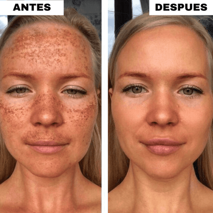Pack  Almohadillas Faciales Anti-Manchas OFERTA 2X1
