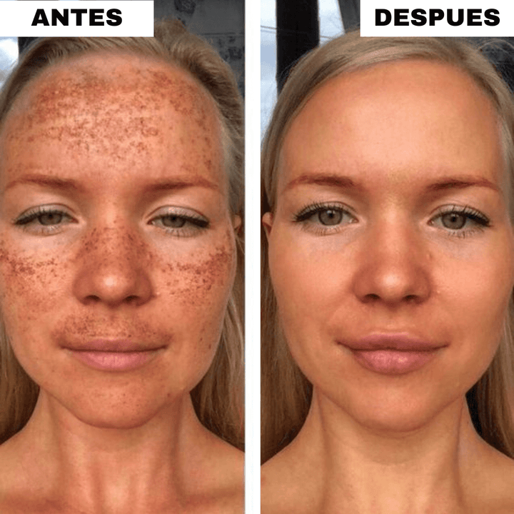 Pack  Almohadillas Faciales Anti-Manchas OFERTA 2X1