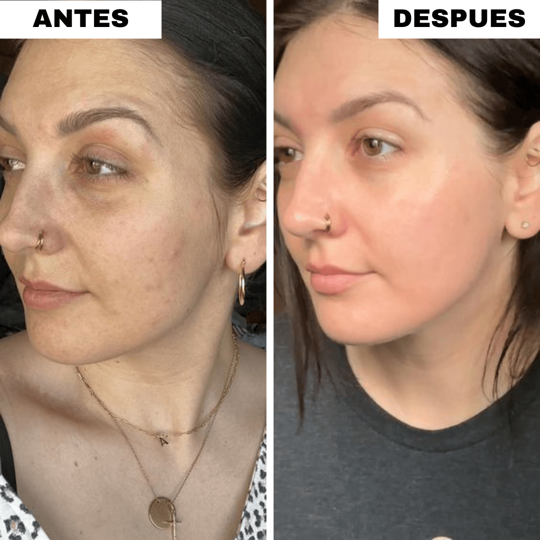 Pack  Almohadillas Faciales Anti-Manchas OFERTA 2X1