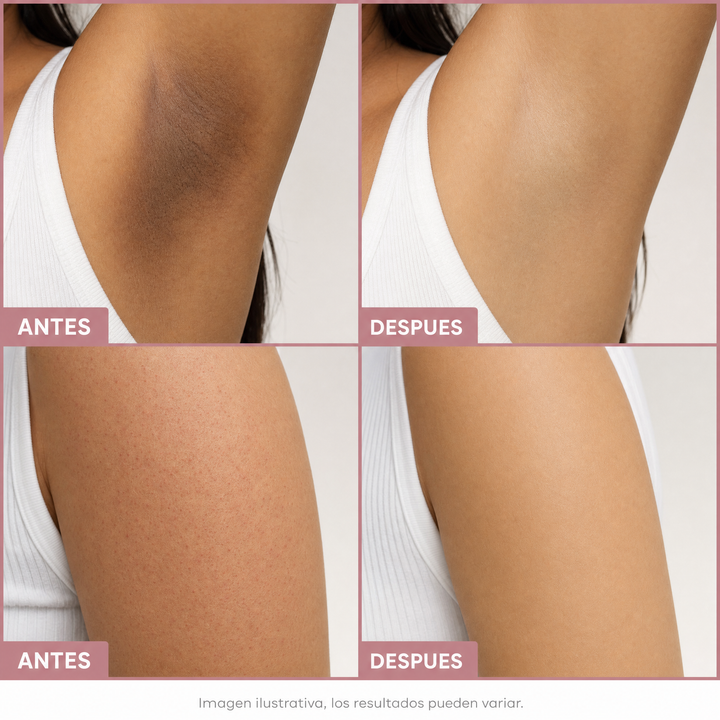 Antes y despues spray exfoliante